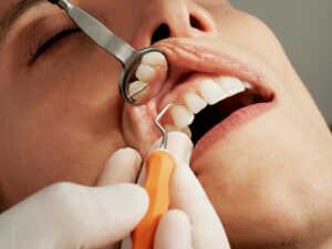 Read more about the article Miglior Dentifricio per Denti Sensibili: Raccomandazioni del Dentista a Gioia Tauro