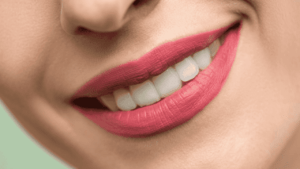 Read more about the article Quanto dura sbiancamento denti? Tutto quello che devi sapere per un sorriso duraturo